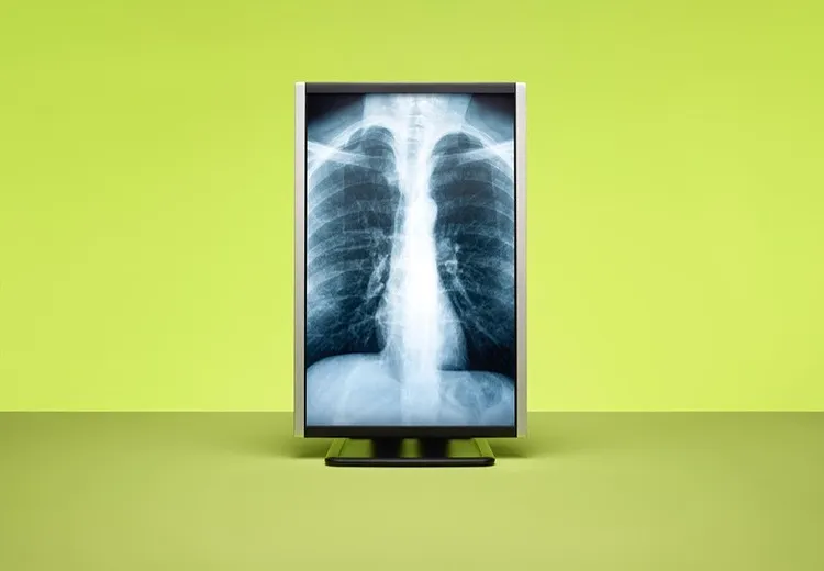 How the Brains Behind IoT Is Transforming Healthcare, Sports, and More